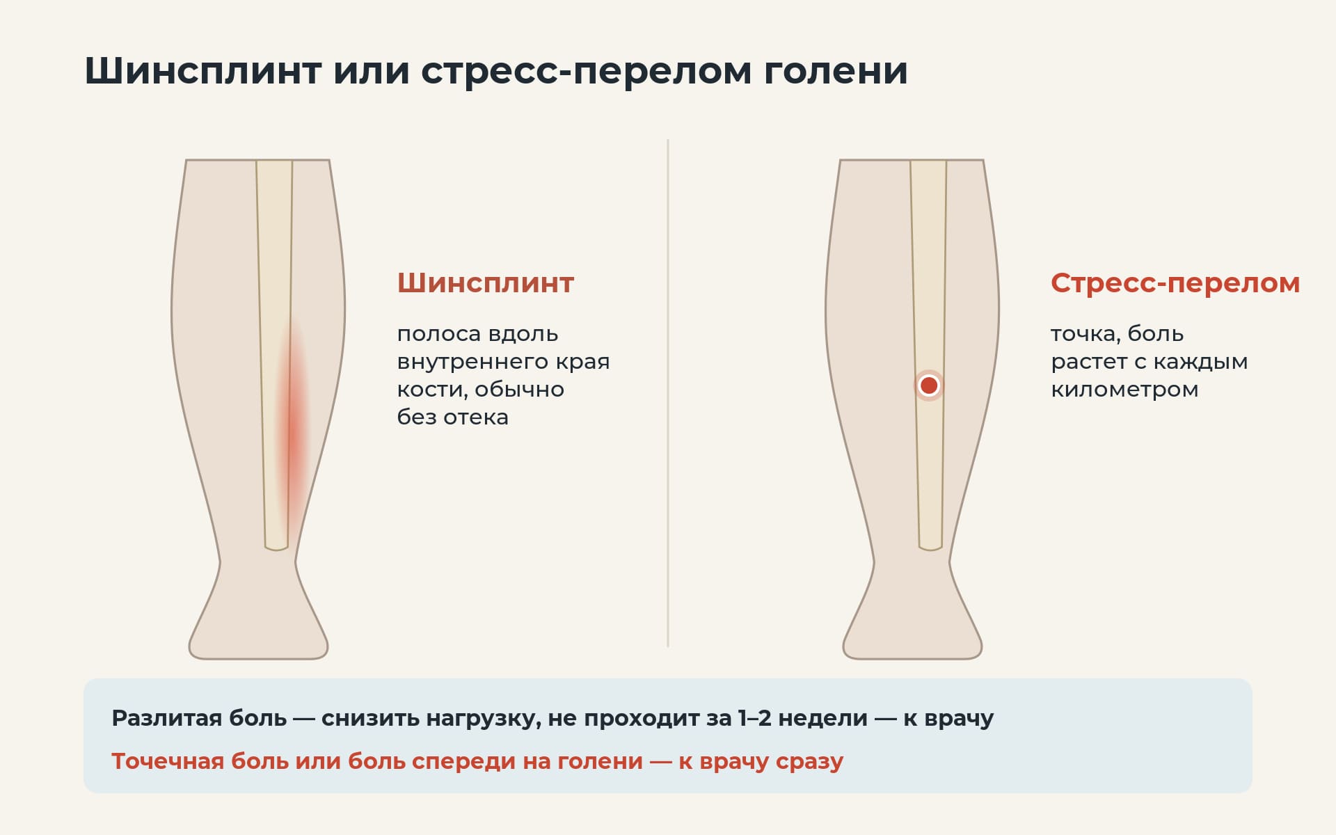 Разница между шинсплинтом и стресс-переломом голени